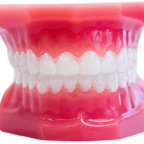 Clear aligners Invisalign treatment model